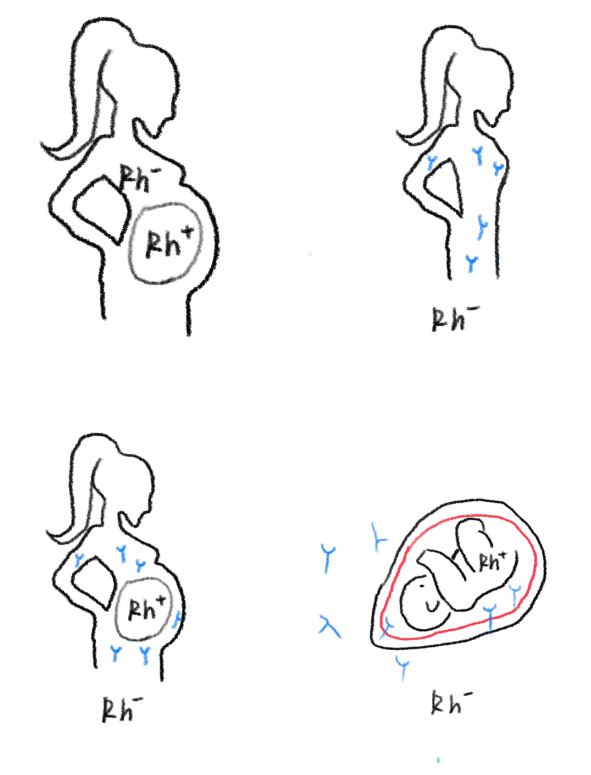 17.png